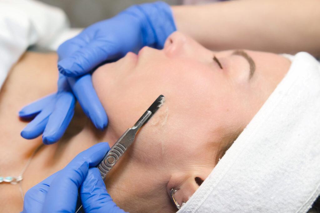 dermaplaning-advanced-skincare-treatment-at-Radiant-Complexions-Skin-Lounge