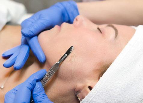 Dermaplaning - Radiant Complexions Skin Lounge