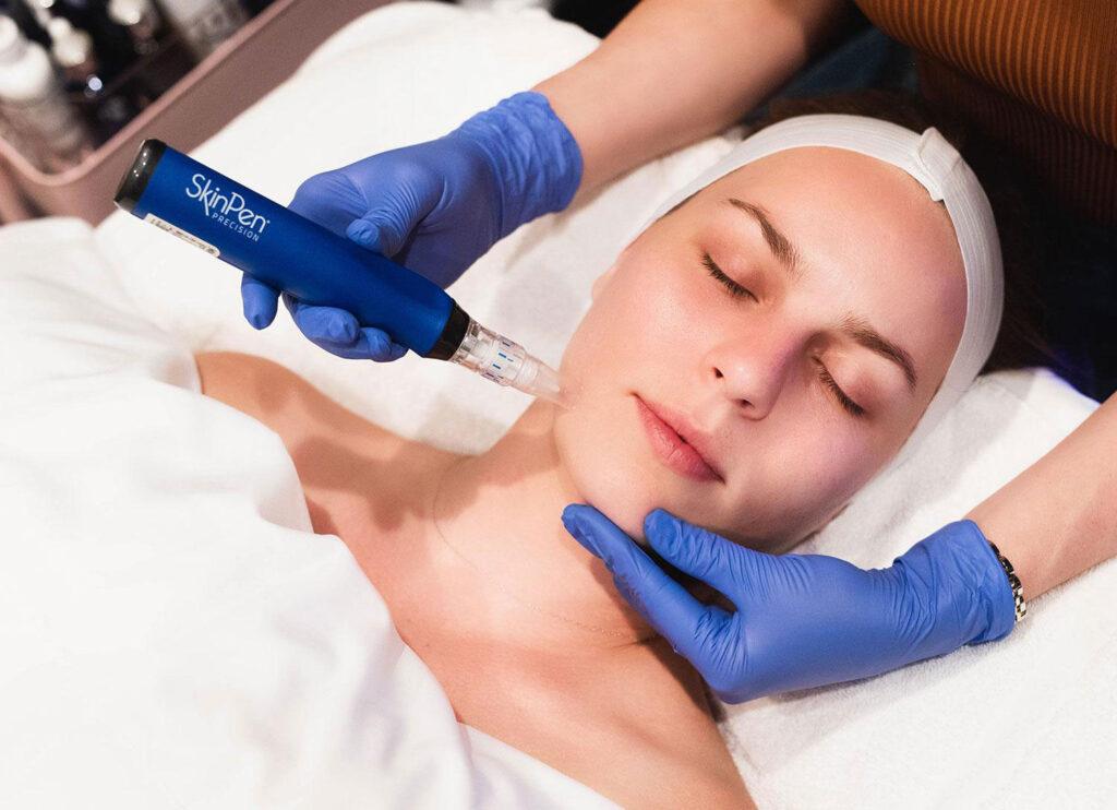 Skin-Pen-Microneedling-at-Radiant-Complexions-Skin-Lounge
